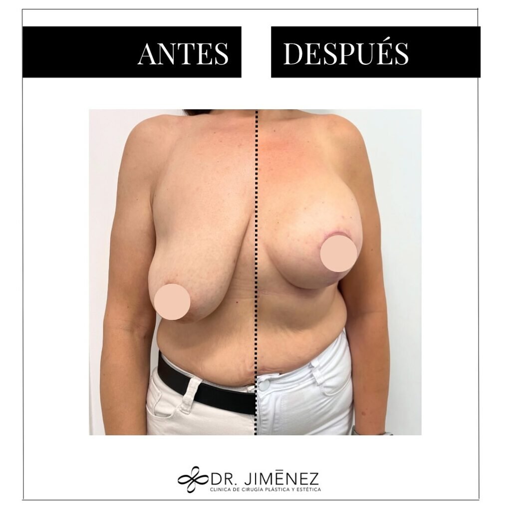 Instagram post from clinicadr.jimenez. This post is in position 0.